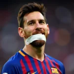 Messi bị gãy răng